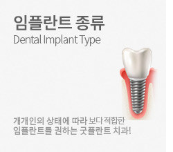 임플란트종류