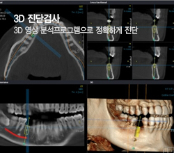 3D진단검사