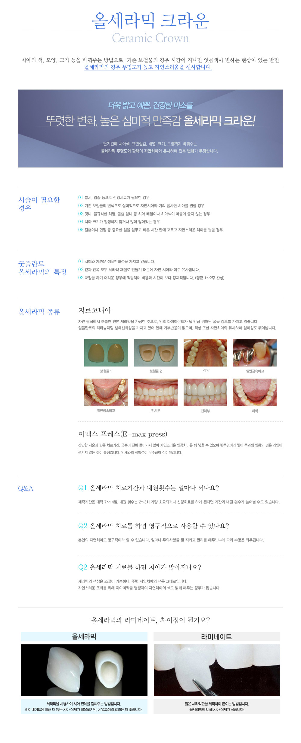 올세라믹크라운